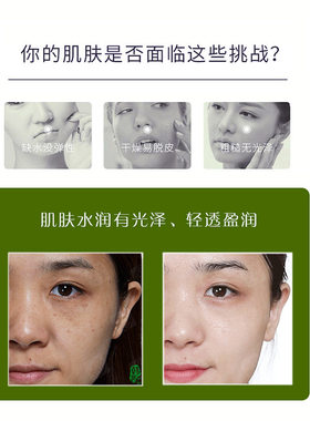 韩茗芦荟原液水乳护肤品套装补水保湿滋润提亮紧致抗皱化妆品全套