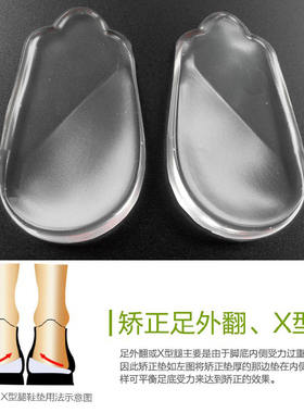 儿童学生内八字矫正鞋垫