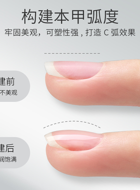 KaSi多合一建构胶加固光疗延长胶