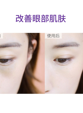 天使羽翼蜗牛娇颜尊宠精华霜眼霜