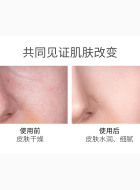 韩国皮肤管理补水保湿精华霜
