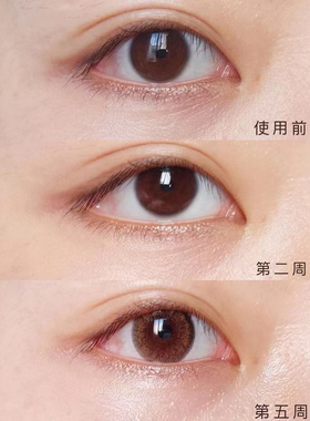 美国桑德丽Sundari 洋甘菊眼油淡化细纹眼部精华油  保湿滋养抗皱
