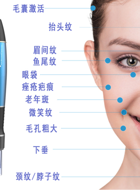 纳米晶片水光电动微针