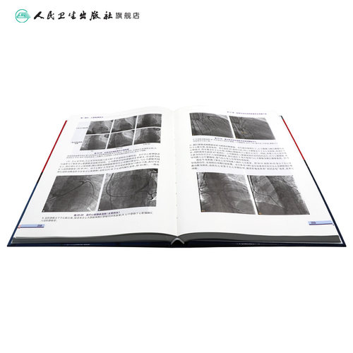 心脏起搏技术第二版华伟阜外心血管内科学介入心脏病学心内科心脏起搏除颤心律失常冠脉介入人民卫生出版社内科学心脏电生理 - 图3