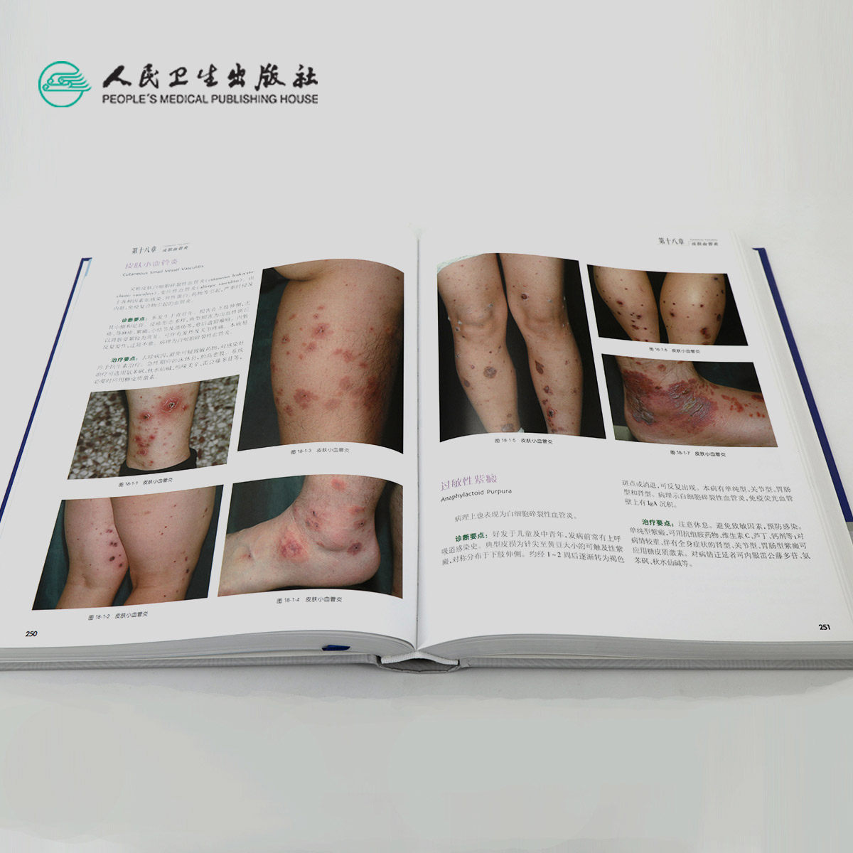 中国皮肤病性病图鉴朱学骏白癜风 人民卫生出版社皮肤病学/性病学