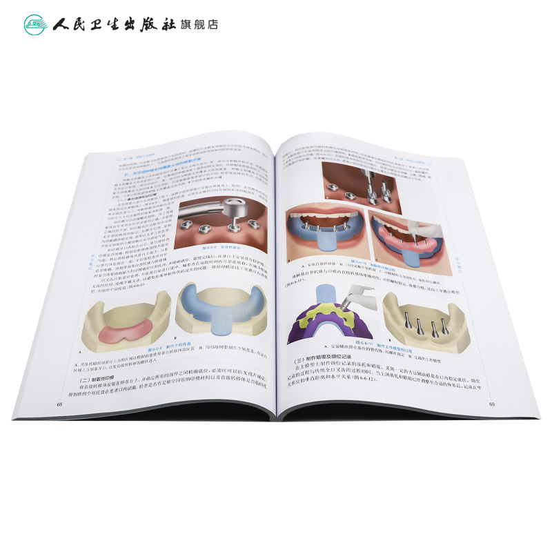 口腔种植学 人卫新版现货口腔十三五教材全套第八轮本科教材口腔颌面牙体牙髓病口腔解剖种植牙周人民卫生出版社口腔医学专业书籍 - 图3
