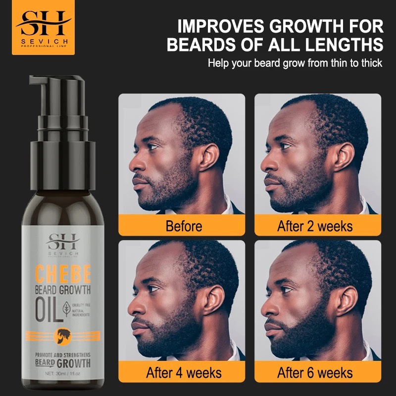 Natural Chebe Men Beard Growth Oil Fast Effective Hair Loss-图1