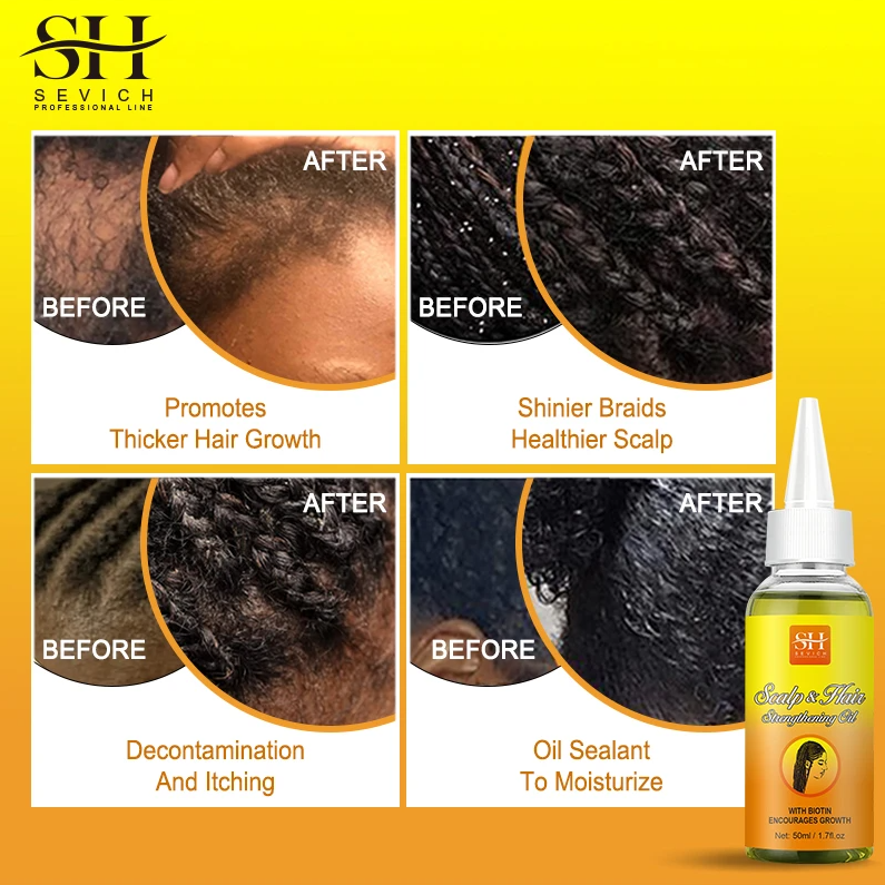 2023 New African Anti-itch Hair Growth Braid Oil Hair Care - 图1