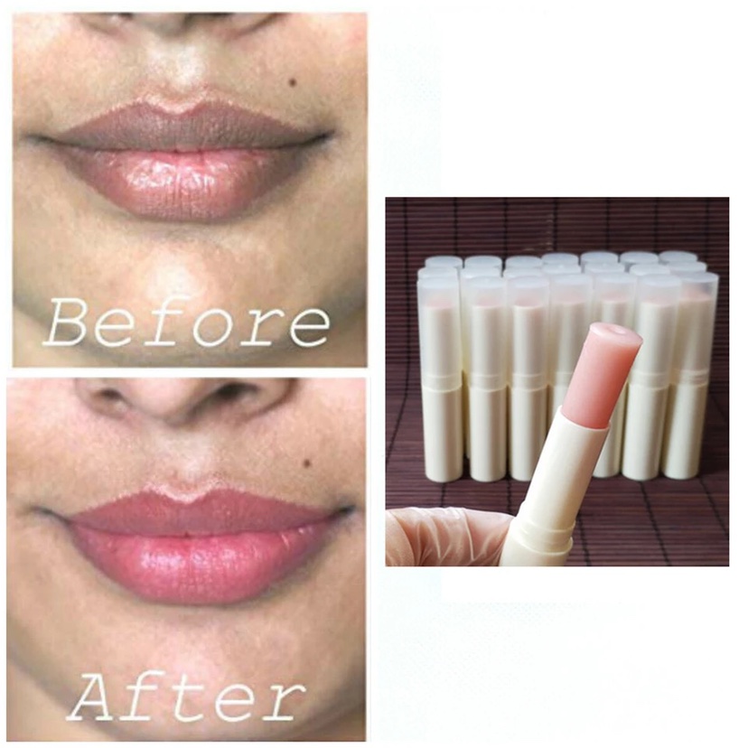 lip Lips Pink  Lightening Bleaching Treatment Remove Dark - 图0