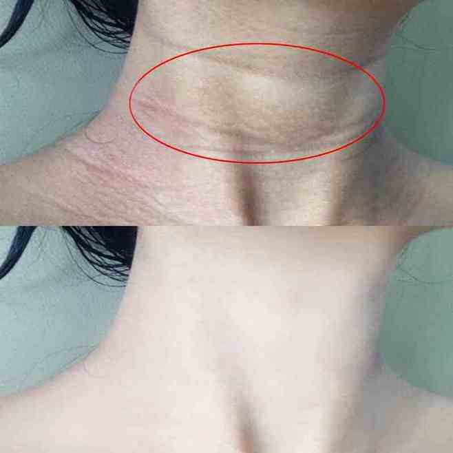 别让颈纹暴露你的年龄~买二送一 靓雪化妆品颈霜