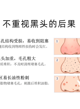 韩国小气泡去黑头导出精华液草莓