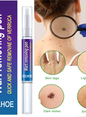 Warts Remover Liquid Antibacterial Ointment Wart Treatment C