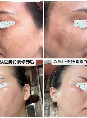 汉焱巨美特亮肤淡纹护肤3件套