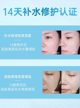 私信聚补水耀闪亮精华面膜保湿
