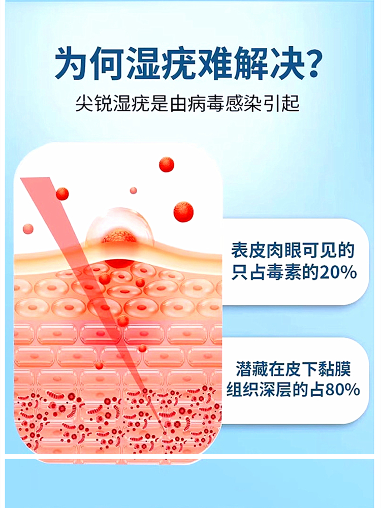 尖锐湿疣 扁平疣肛周疣凝胶鸡疣丝状疣去疣药膏鸡眼刺瘊子hpv病毒 - 图0