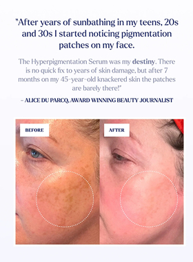 现Skin Rocks The Hyperpigmentation Serum淡化黑斑紅斑色素精华
