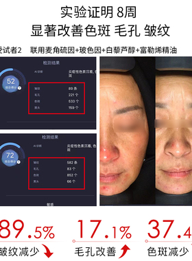 麦角硫因全能亮肤乳 脱羧肌肽 光甘草定 橙花  亮肤抗氧 30mL