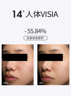 SOUNDER ONE三蛋丸15%壬二酸净颜精华乳