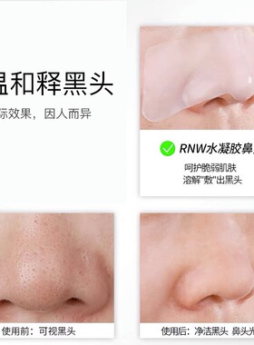 RNW如薇鼻贴敷出黑白头