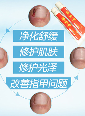 孕妇灰甲药膏黄金甲指甲修护膏