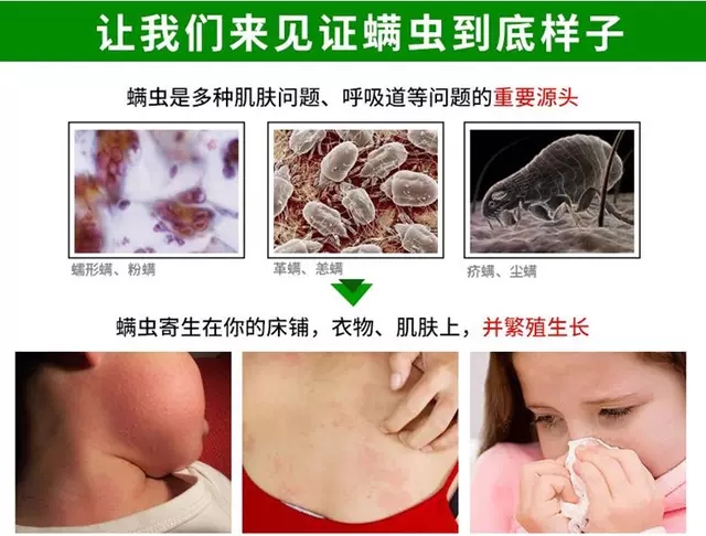 3瓶0.05%二甲基丙烷羧酸酯溶液衣物床上用消毒液杀虫剂疥虫螨虫 - 图1