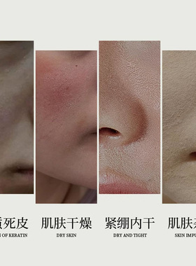 琪瑟紫苏库拉索芦荟凝胶300g补水保湿改善干燥舒缓泛红闭口正品