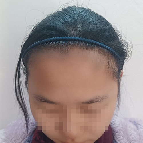 台湾细蝇不夹头长齿防滑软发箍压发碎发头饰盘发马尾洗脸过年发夹 - 图0