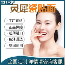 DensersberciNordling rhinoceros porcelain full porcelain veneered to import 3 generations of teeth patches beauty tooth whitening