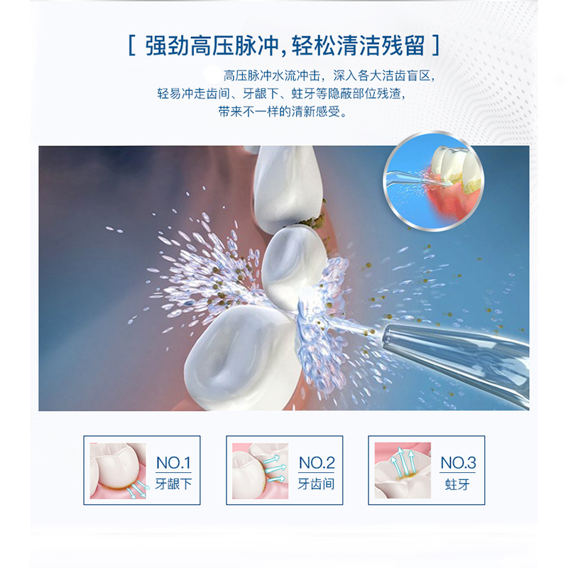 适用洁碧waterpik冲牙器水牙线喷头标准经典喷嘴替换头配件8色 - 图2