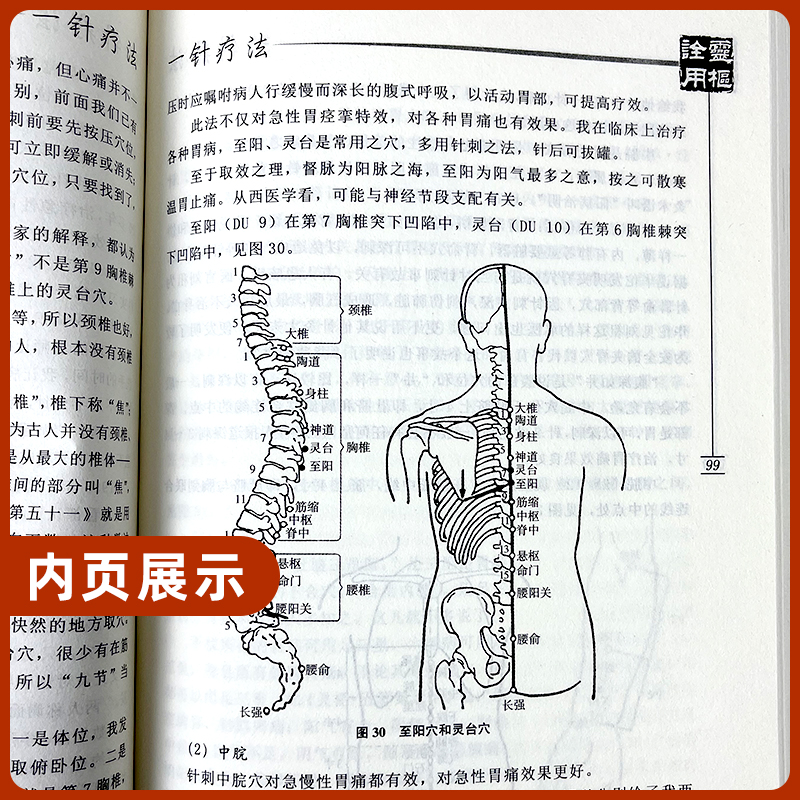 正版一针疗法灵枢诠用高树中中医养生书籍入门经络穴位家庭养生中医针灸自学基础理论书籍零基础学针灸学黄帝内经内针灵枢经-图1