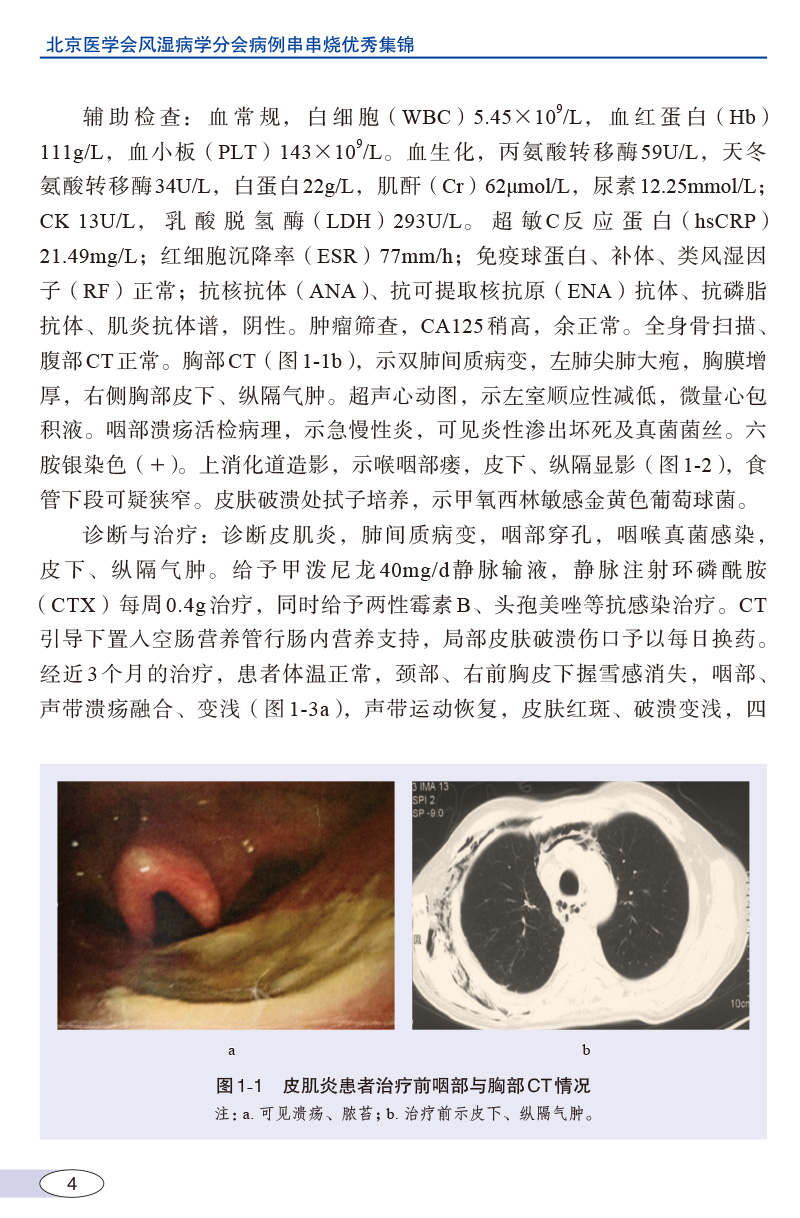 正版 北京医学会风湿病学分会病例串串烧优秀集锦 中国协和医科大学出版社 李梦涛 苏茵 - 图3