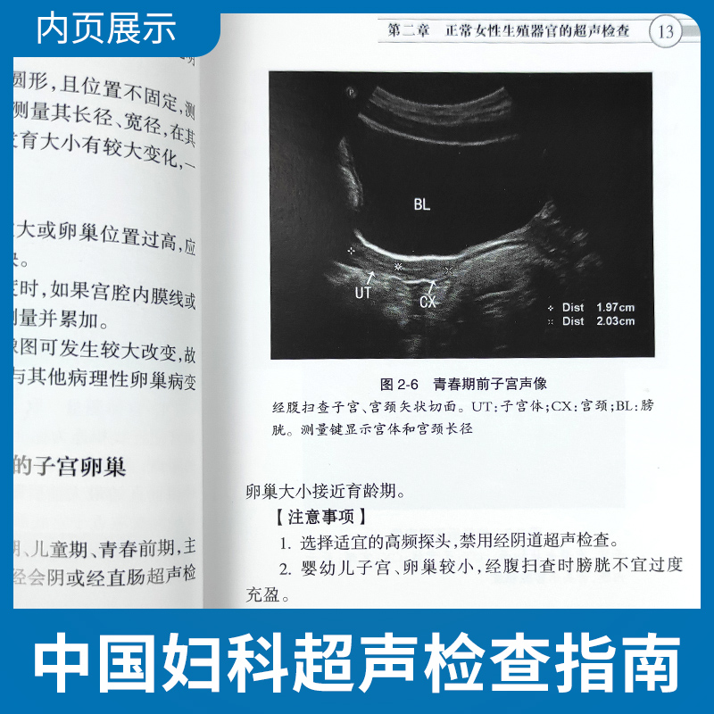 正版 中国妇科超声检查指南 中国医师协会超声医师分会指南丛书 人民卫生出版社超声诊断学超声医学书籍医学影像学可搭配奈特断层 - 图2