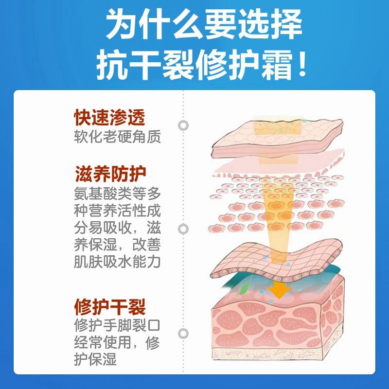 裂可宁理发店美发师助理发廊洗头工专用修护手霜滋润保湿防干防裂 - 图1