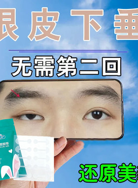 上眼皮下垂提拉脸部眼皮防松弛矫正眼肌无力大小眼眼部提拉贴矫正