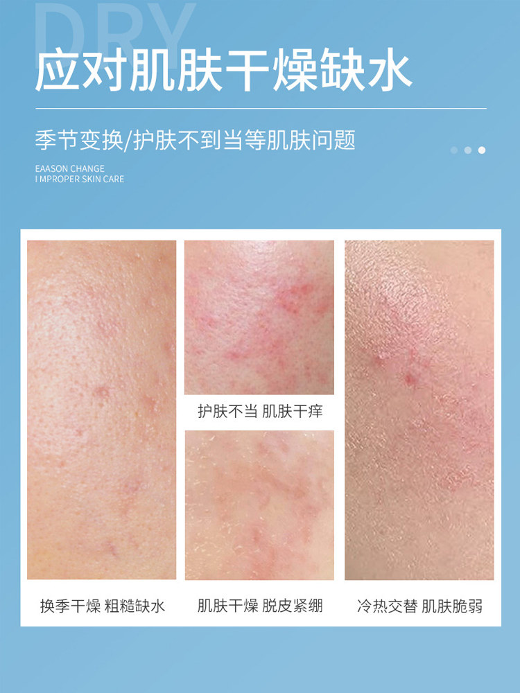 正品凡士林脚后跟干裂特护膏手足粗糙脱皮护脚手霜保湿滋润去角