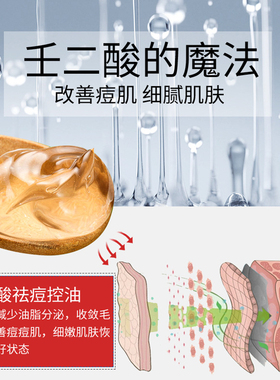 德德维芙壬二酸祛痘凝胶20g发2支 抑痘抗痘改善痘肌保湿控油修护