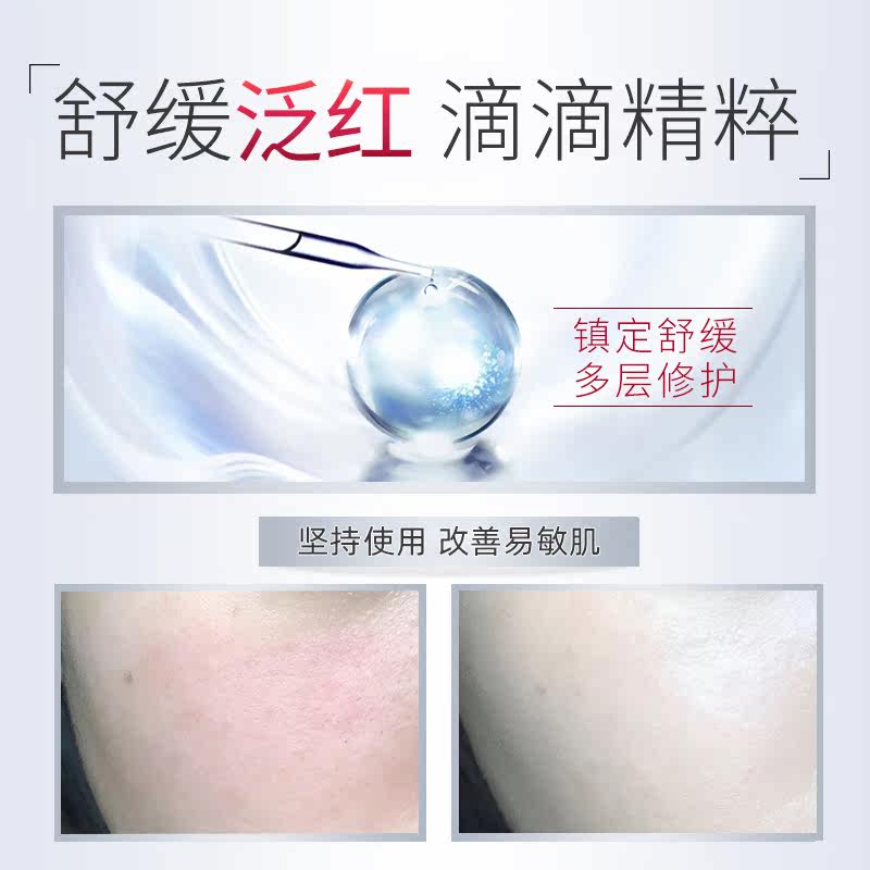 芷轩堂去除红修护角质层洋甘菊晒后 芷轩堂液态精华