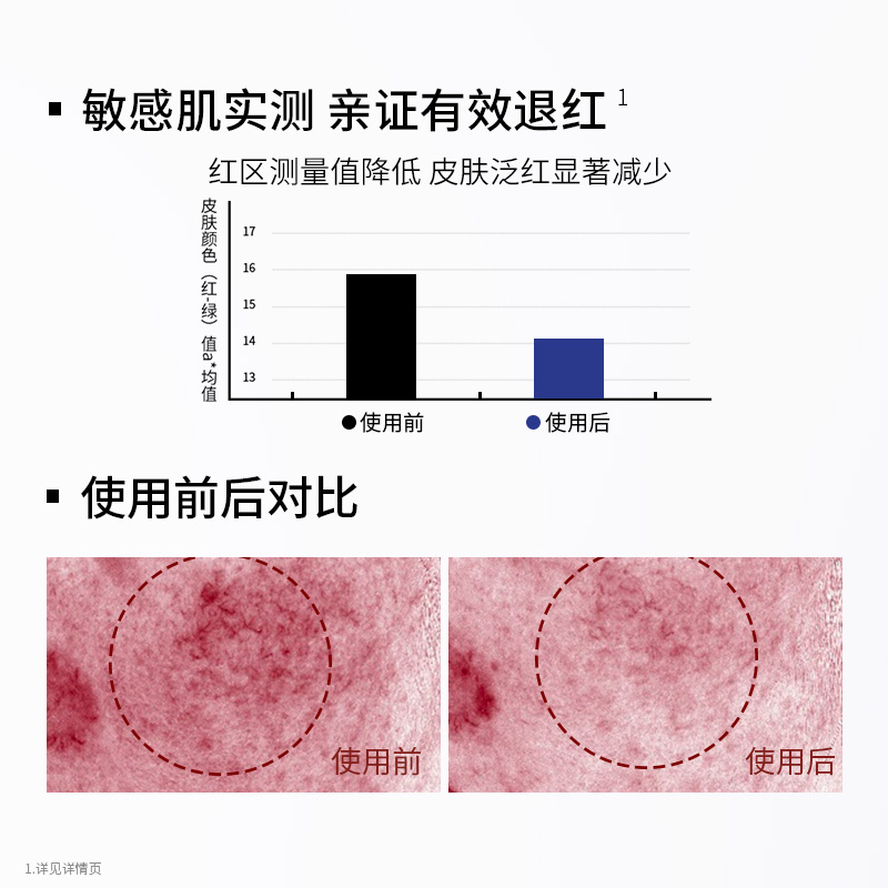 袋鼠妈妈高山火绒草舒缓修护乳准孕妇乳液补水保湿护肤品化妆专用-图3