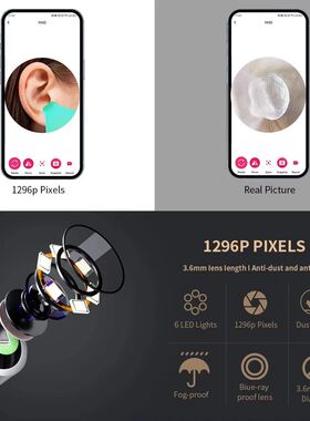 Smart Visual Ear Cleaner with Camera
