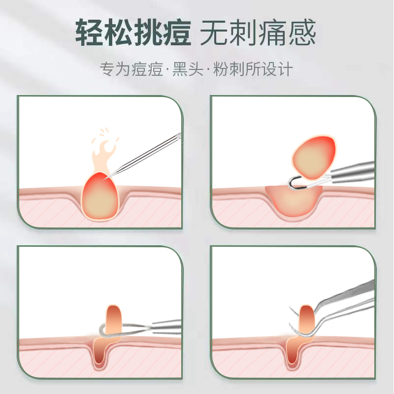 粉刺针去黑头细胞夹套装祛痘暗疮针镊子挤痘痘挑痘工具神器-图1