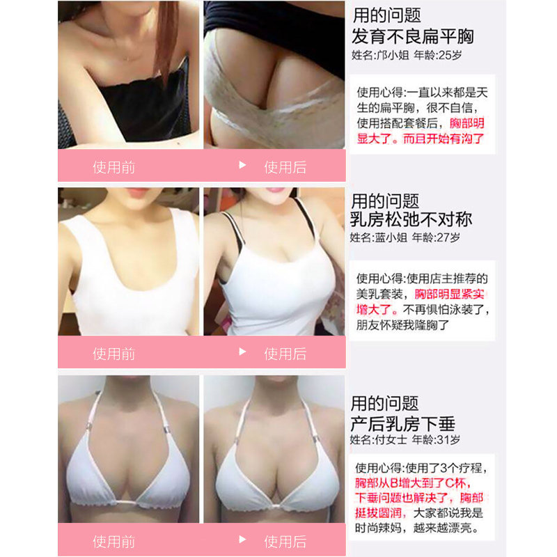  抖音网红专盈店家用胸部护理仪