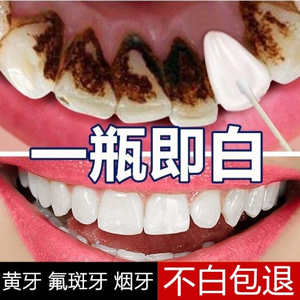 牙齿神器去黄洗白变亮白污垢洗牙粉 依伊牙齿护理体验馆牙粉