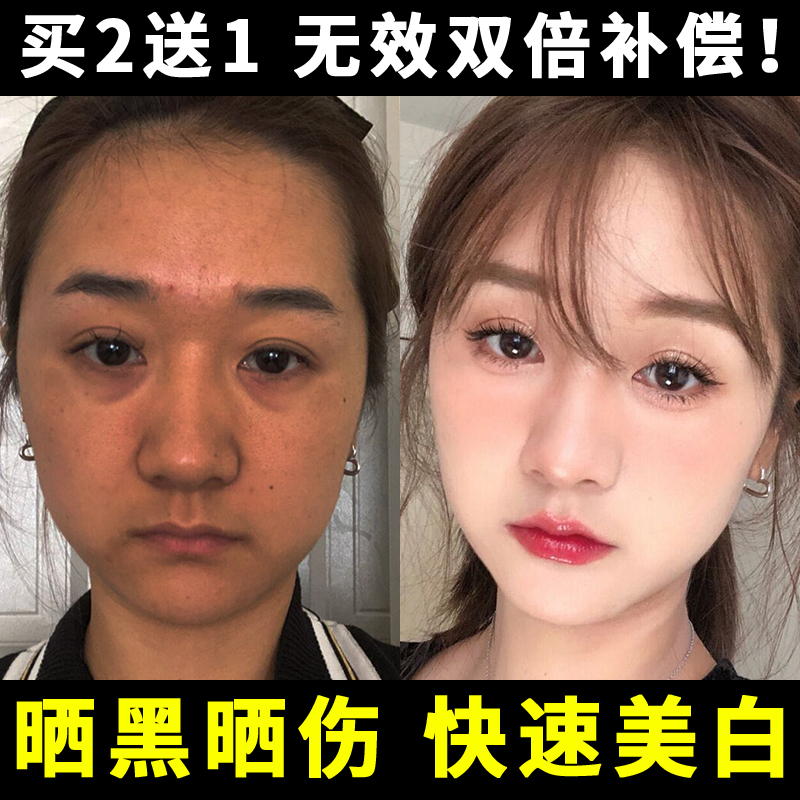 晒黑了修复快速变白儿童晒后皮肤紫外线晒伤美白女男士霜身体脸乳 - 图2