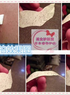 去黑头粉刺鼻贴黑头贴