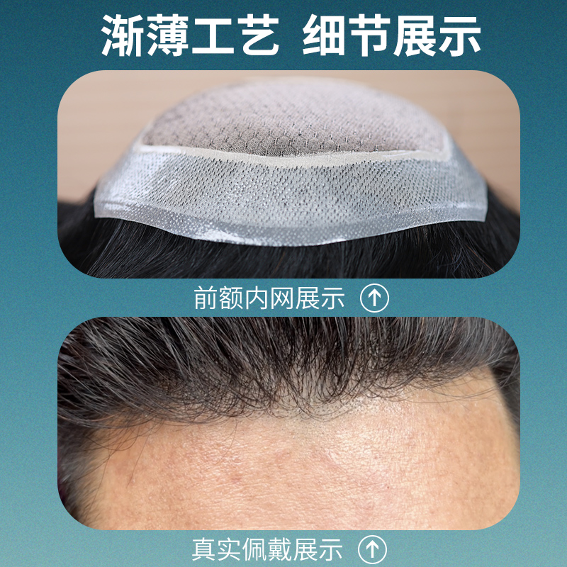 假发男生头顶真发织发块碎盖短发发际线增发量刘海补发片帅气无痕 - 图1