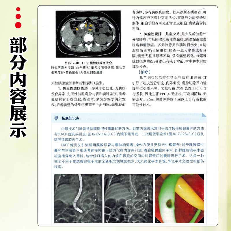 正版 儿童消化病学 附视频 江米足 龚四堂 儿童消化病临床实用诊治思路及经验 儿科医生临床 工具书 人民卫生出版社9787117352284 - 图3