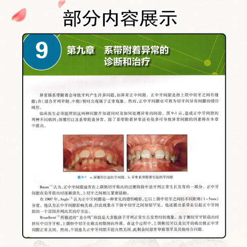 正版 儿童口腔早期矫治 卫光曦 儿童早期矫治书 口腔早矫书籍 儿童早期矫正书 儿童口腔医学书籍 正畸书籍 牙科书籍人民卫生出版社 - 图3