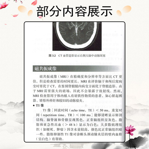 正版 神经内科值班医生手册 第四4版 元小东主译 北京大学医学出版社9787565925252 - 图3