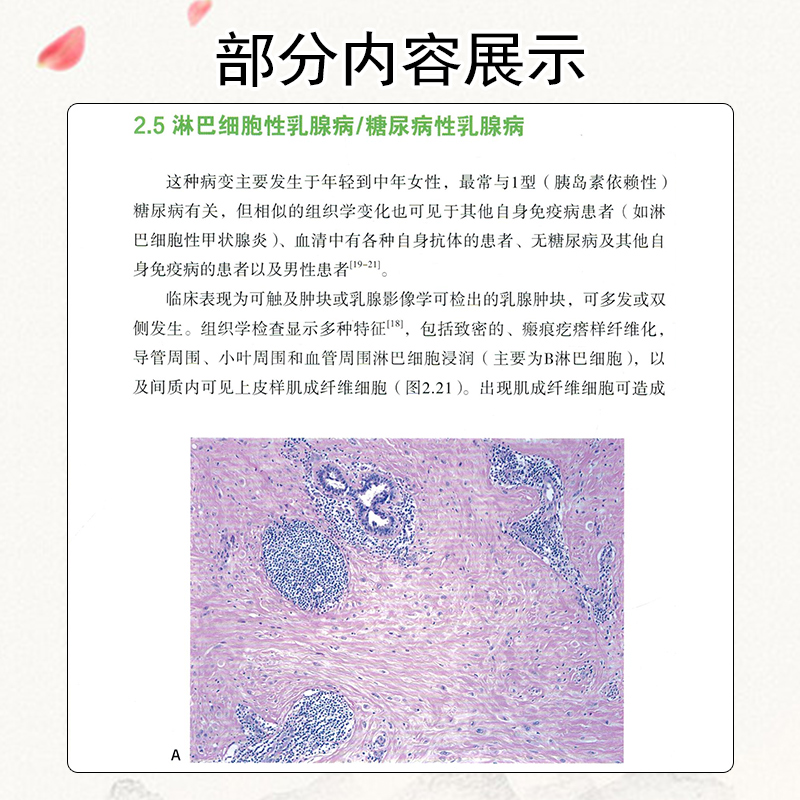 正版 乳腺病理活检解读第3版第三版 病理活检系列丛书 李国霞主译 北京科学技术出版社9787571403256 - 图3