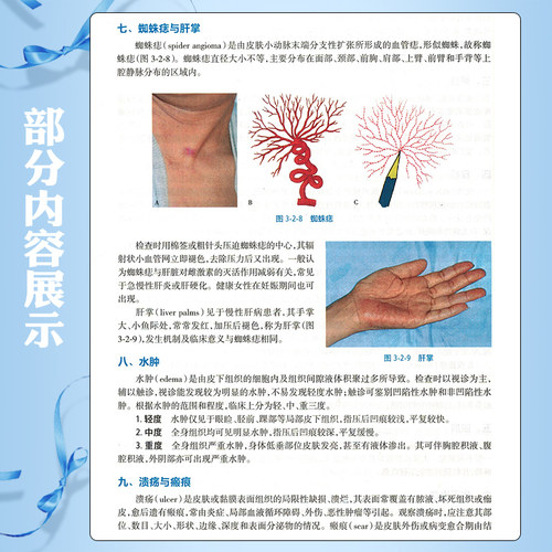 诊断学 第9九版  许有华 樊华 主编十四五规划教材全国高等职业教育专科教材供临床医学专业用 人民卫生出版社9787117371797 - 图2